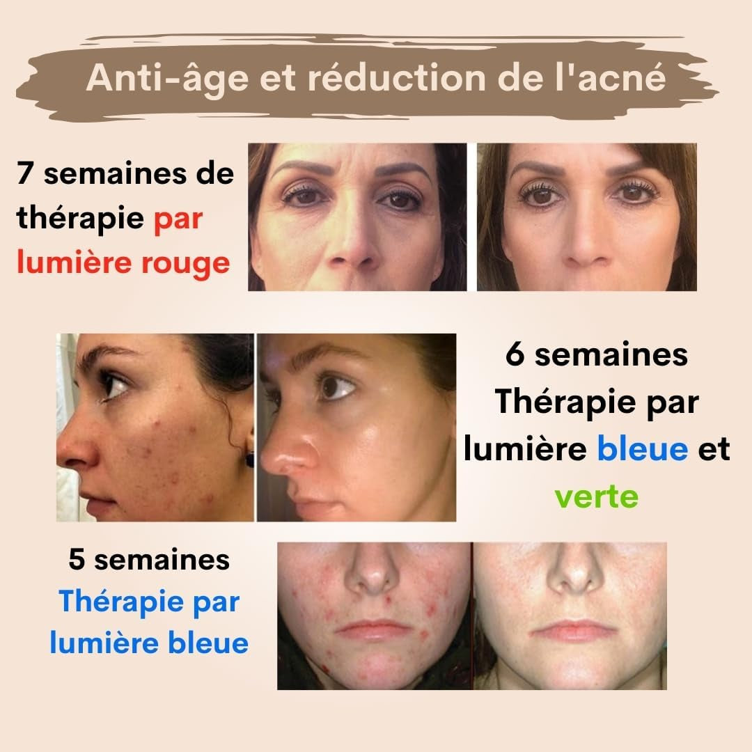 Dermawave Masque Led Visage Luminothérapie - 7 Couleurs (Rouge Et Bleu) Masque Pour Le Visage - Pack De 10 Sérums Et Livre Électronique - Appareil De Soin De La Peau Du Visage Pour Rajeunissement