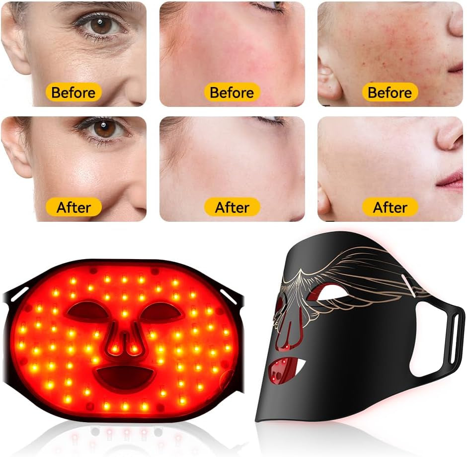 Masque De Luminothérapie À LED, 4 Couleurs, Rajeunissement De La Peau, 240 LED, Masque De Lumière Rouge, Masque De Luminothérapie Pour Soins De La Peau Du Visage, Anti-Âge (Or)